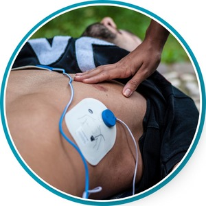 ELECTRODO DESFIBRILACION